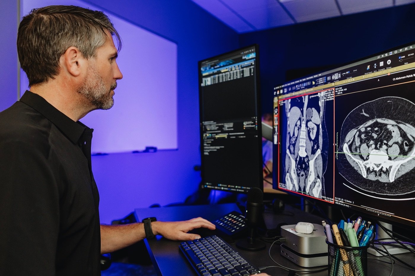 Radiologist reading a CT study at his workstation