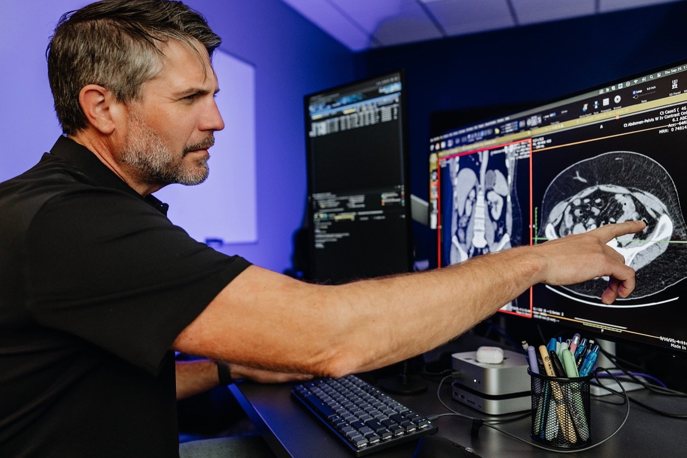 Radiologist pointing to a finding on a CT scan