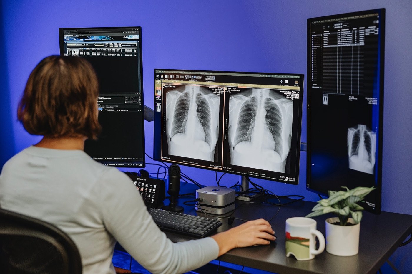 Radiologist reviewing chest X-rays across a multi-monitor reading station